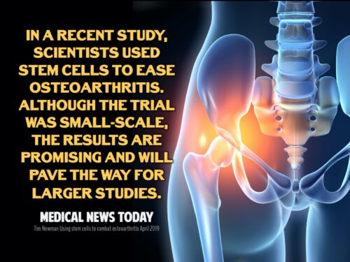 Stem Cells