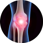 Osgood-Schlatter