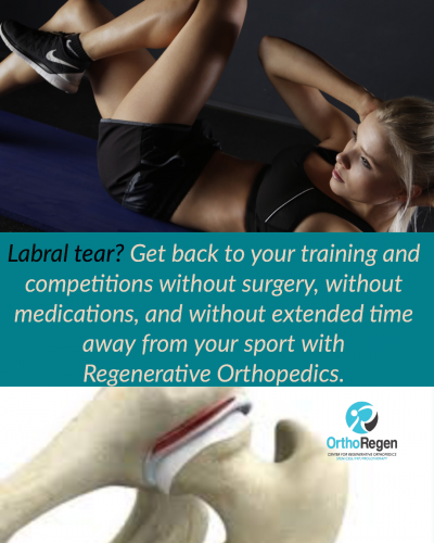 Labral Tear