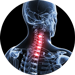 neck pain