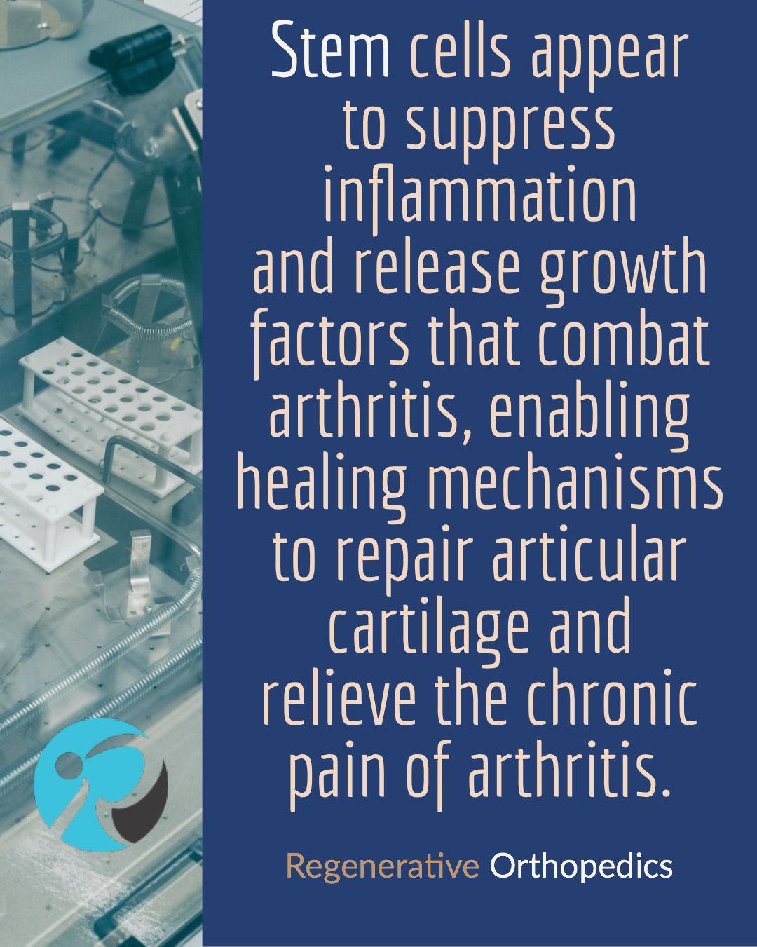 Stem Cell Treatment Los Angeles Alternative To Joint Replacement