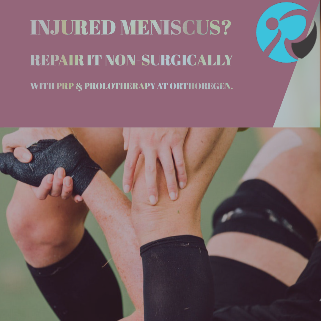 Meniscus Tears Is Surgery a Good Option? Peter A. Fields, MD, DC