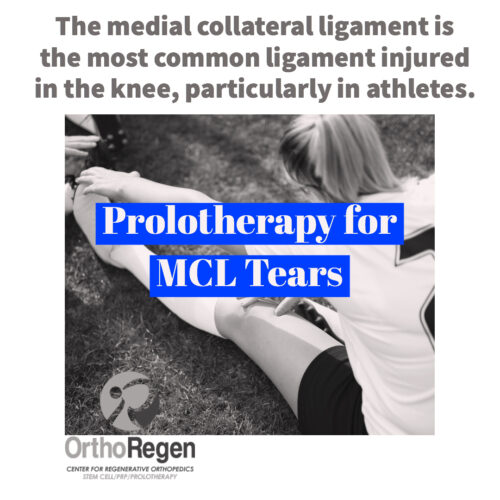 Medial Collateral Ligament Injuries