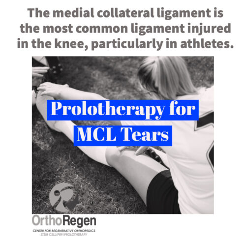 Medial Collateral Ligament Injuries