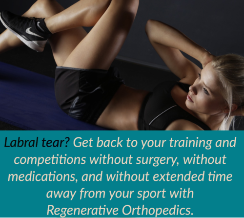 Labral Tear Copy