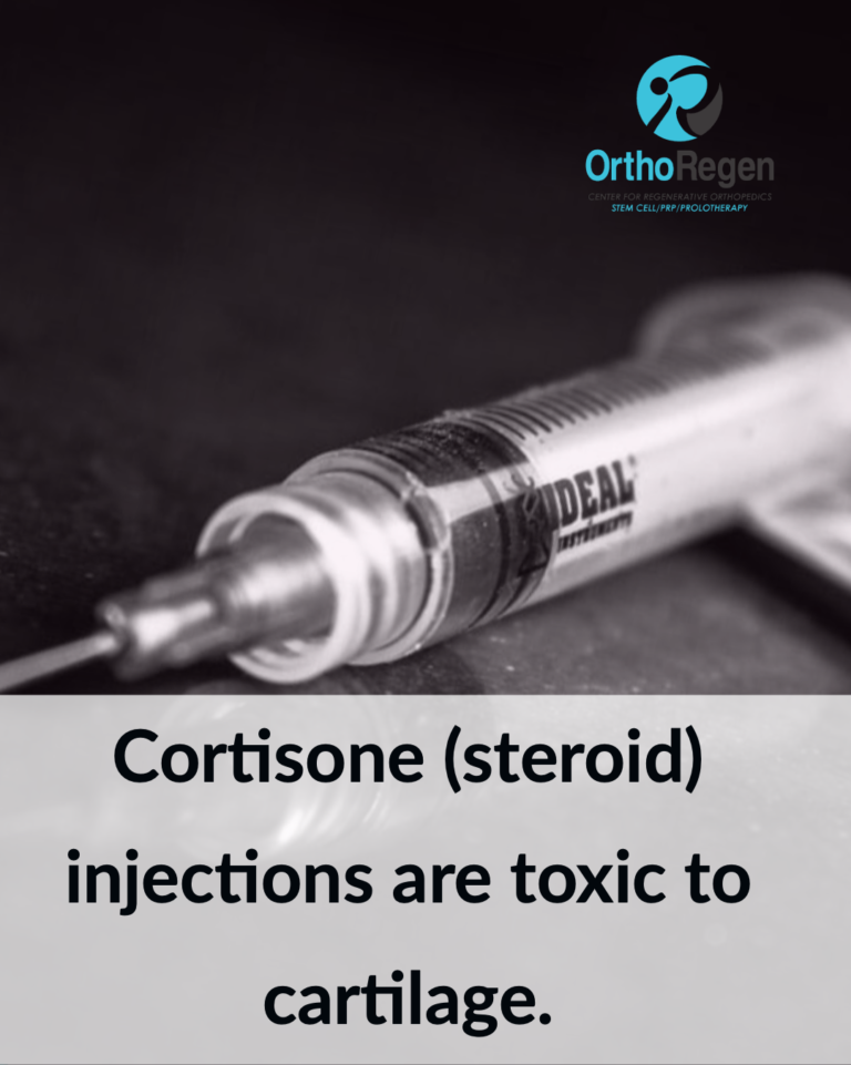 Cortisone Injections Are They As Safe As You Think Peter A. Fields