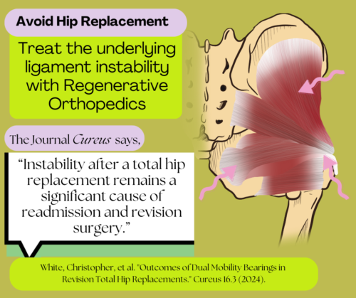 Hip Replacment.cureus (2)